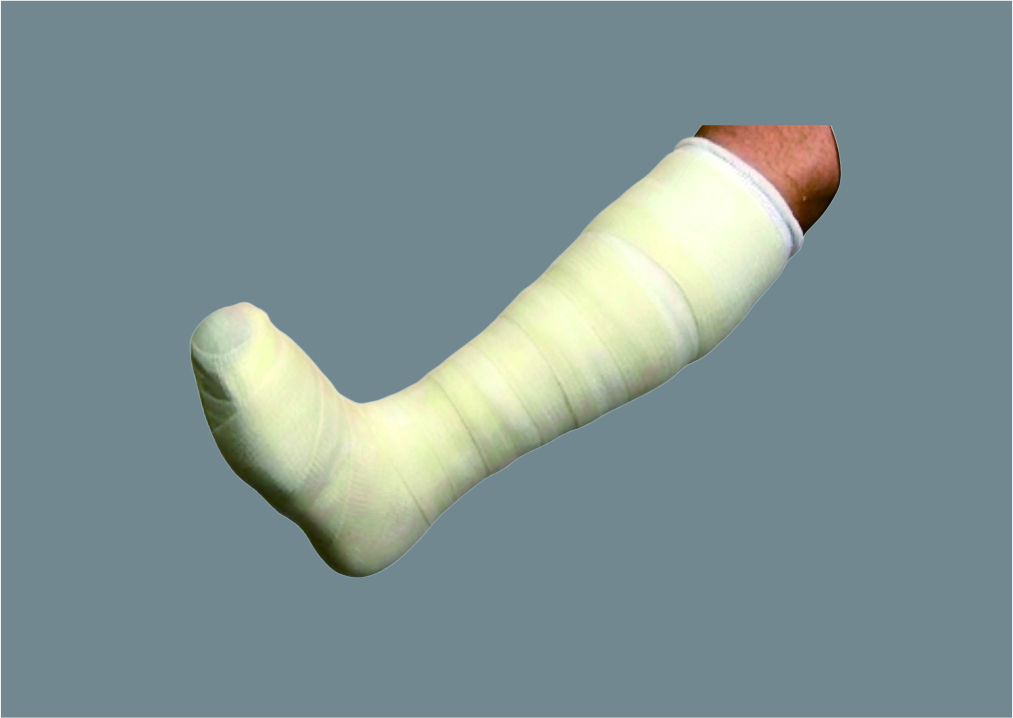 全接触TCC